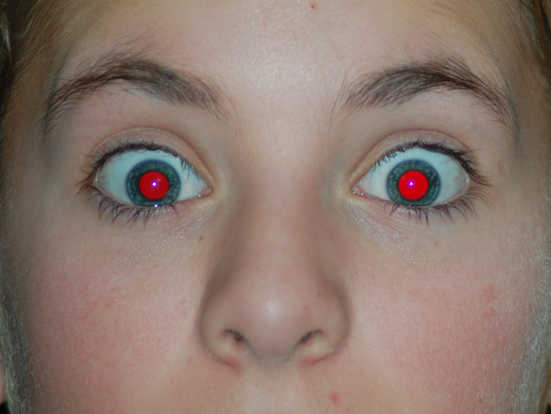 Red Eye